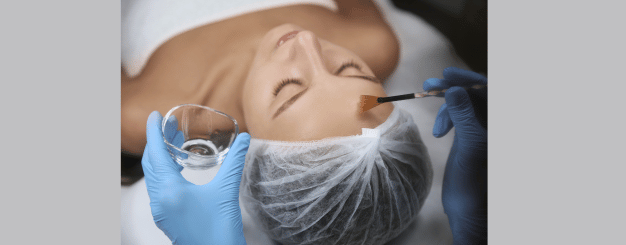 peeling-de-fenol